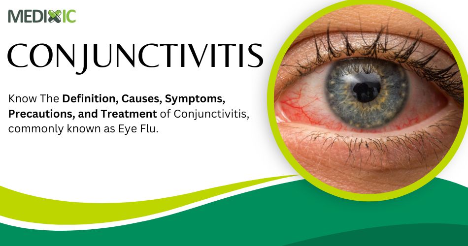 Conjunctivitis