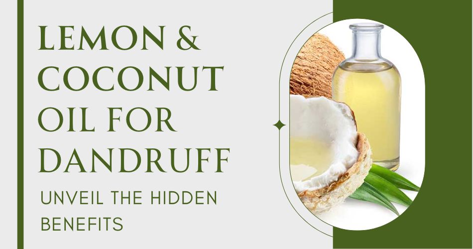 Lemon and Coconut Oil for Dandruff